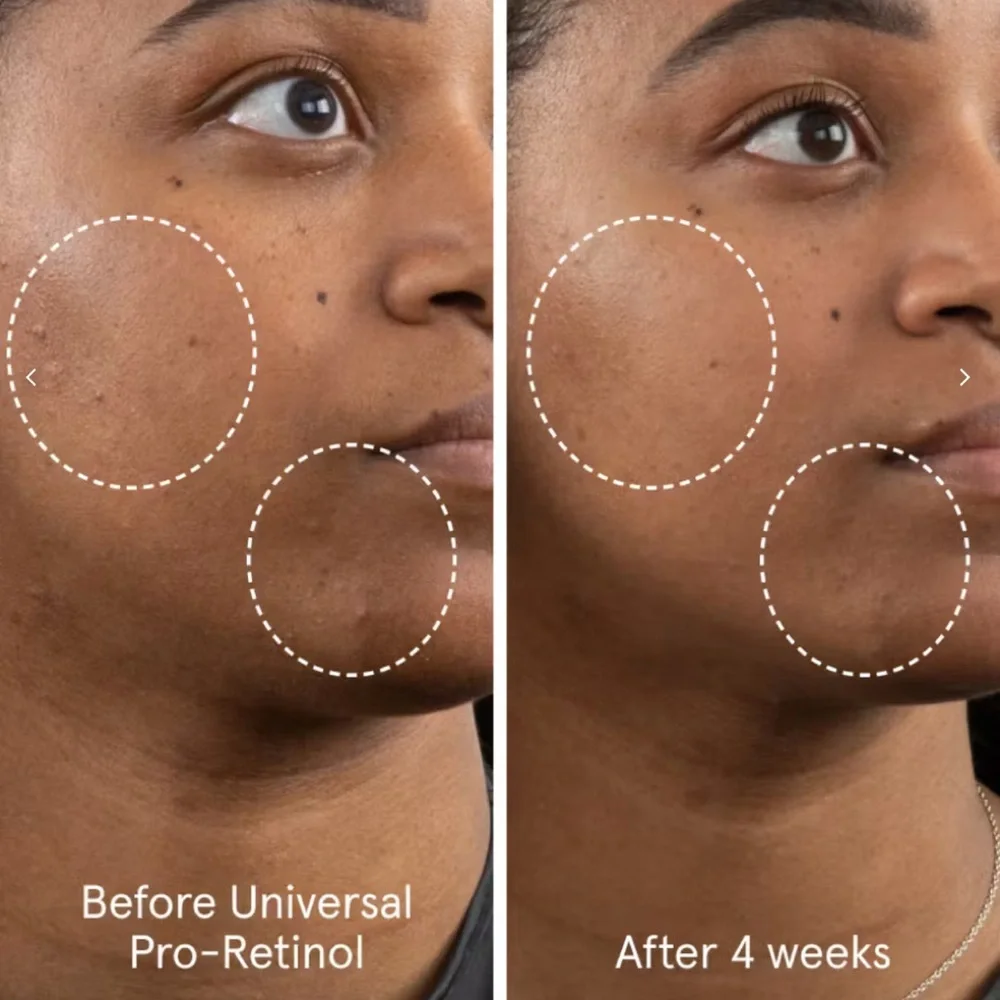 Glossier Universal Pro-Retinol Serum - Pink and Silver